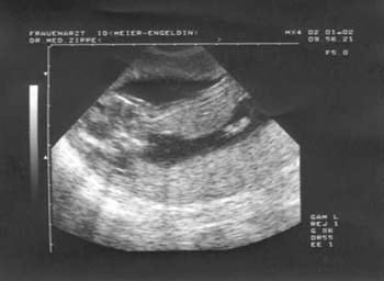 baby-bild004-02012002