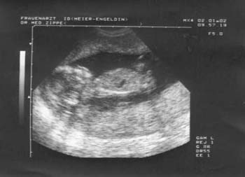 baby-bild005-02012002