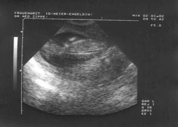 baby-bild006-02012002